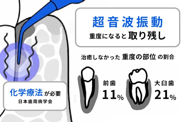 ブルーラジカル