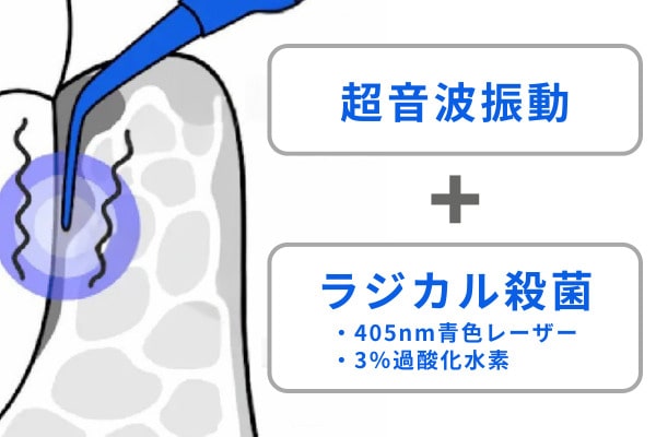 ブルーラジカル