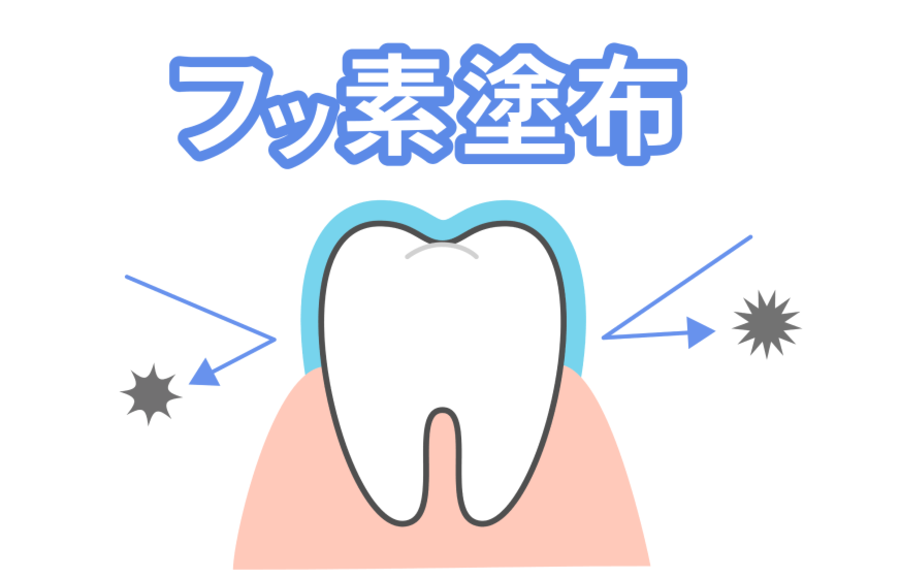 予防歯科